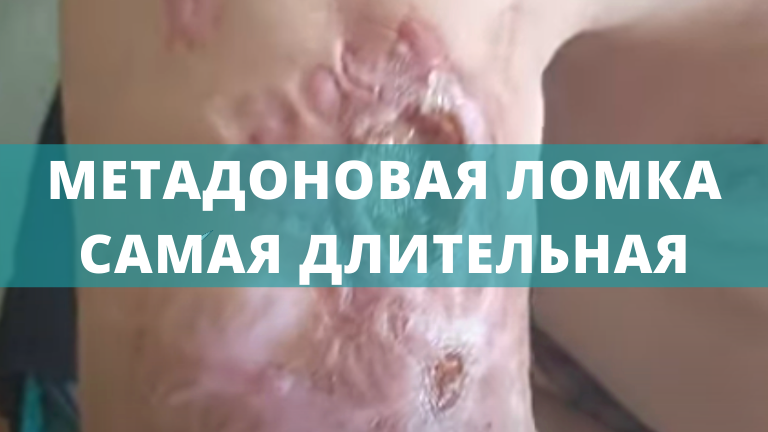 Метадоновая ломка (4).png Метадоновая ломка (4).png