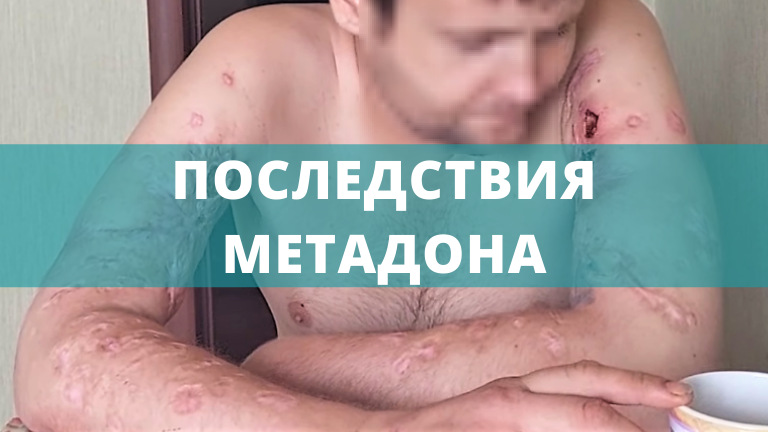 Метадоновая ломка (3).png Метадоновая ломка (3).png